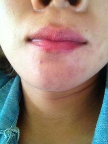 嘴唇长痣搞笑,揭秘嘴唇长痣的搞笑人生！