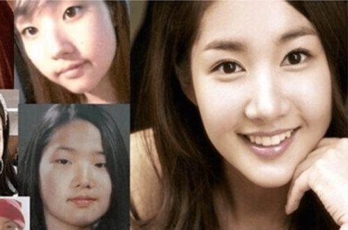 整形成功明星,明星如何通过整形成就辉煌人生